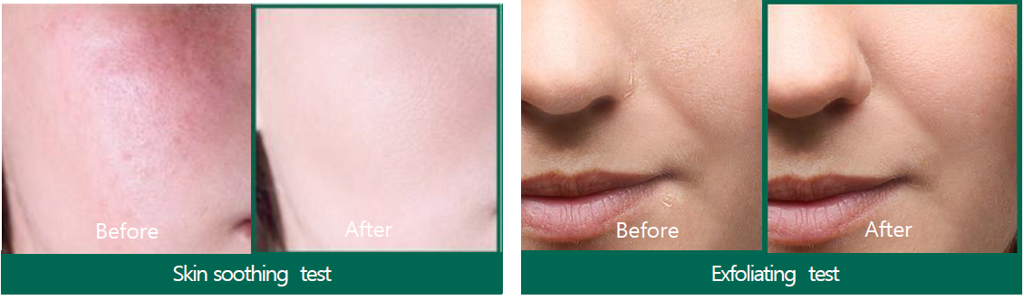 SOMEBYMI AHA-BHA-PHA 30 days Miracle Serum